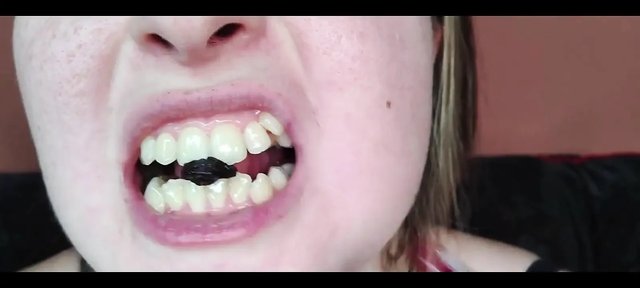 My Mouth, Teeth, Tongue and Throat up Close